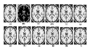 ترجمه مقاله تحلیل کارایی روش دسته بندی فازی C-Means برای قطعه بندی عکسهای MRI