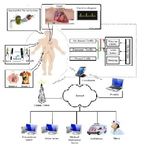 ترجمه مقاله بررسی امنیت وچارچوب امنیتی IEEE 802. 15.4 برای شبکه های بی سیم بدن ( WBAN)